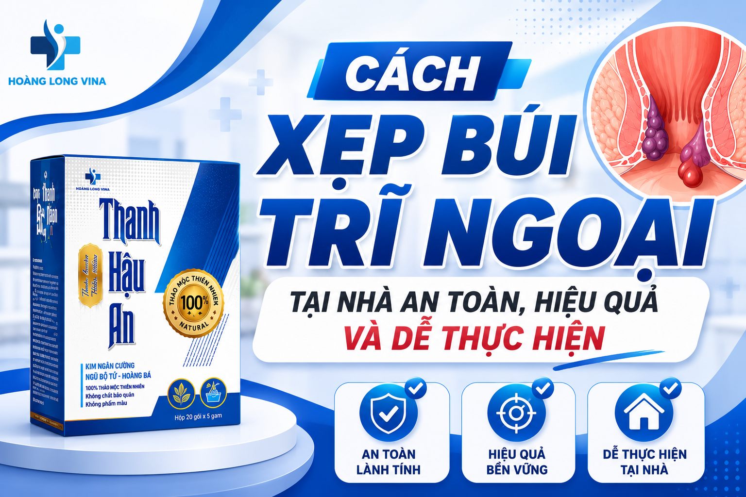 Cách xẹp búi trĩ ngoại tại nhà an toàn, hiệu quả và dễ thực hiện
