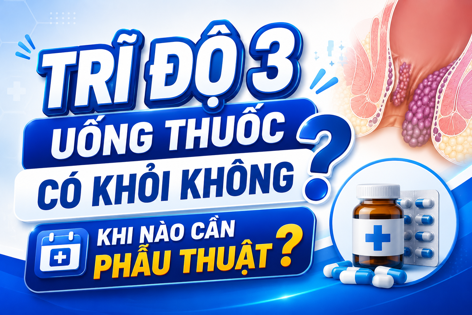 Trĩ độ 3 uống thuốc có khỏi không? Khi nào cần phẫu thuật?