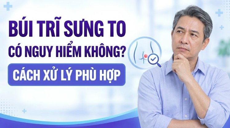 Búi trĩ sưng to có nguy hiểm không? Cách xử lý phù hợp 